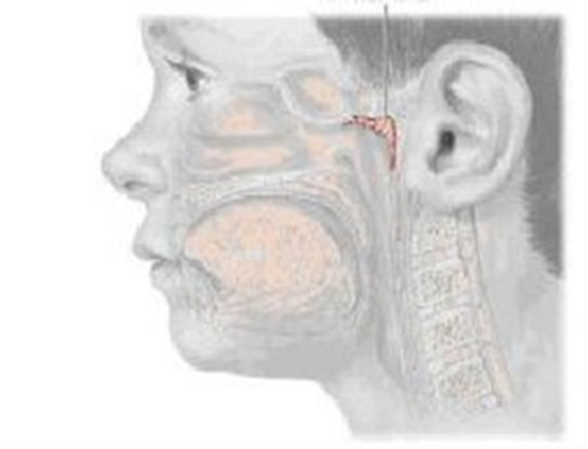 ontstoken neusamandelen