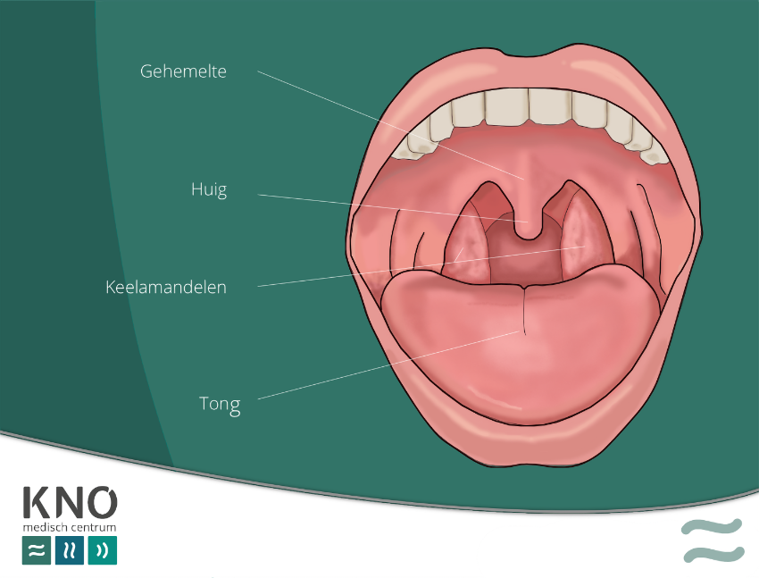 vergrote neusamandelen
